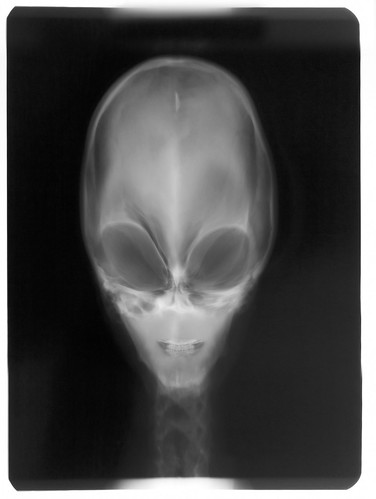 Gravityx9님이 촬영한 Alien X-ray ~(DownunderChallenge210)~.