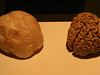 brain and its sac