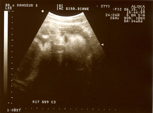 34week-ultrasound3