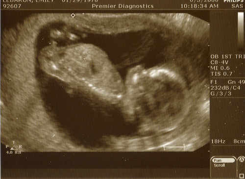First Ultrasound by you.