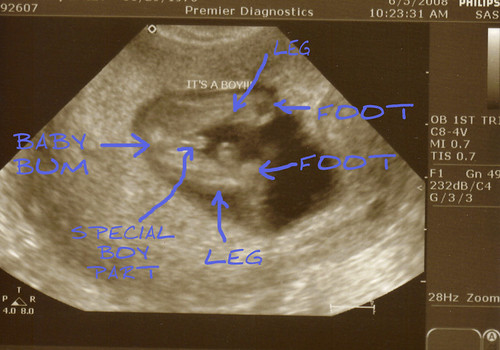 First Ultrasound- Boy Part by you.