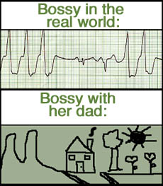 EKG-before-after