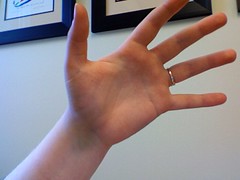 my nearly-broken hand