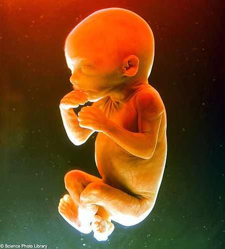 images of 5 week fetus. 13 week fetus