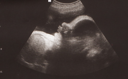 ultrasound 35 weeks-profile.jpg