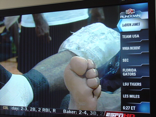 PHOTO: Does LeBron James Have Six Toes 