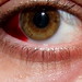 My Nasty Eyeball