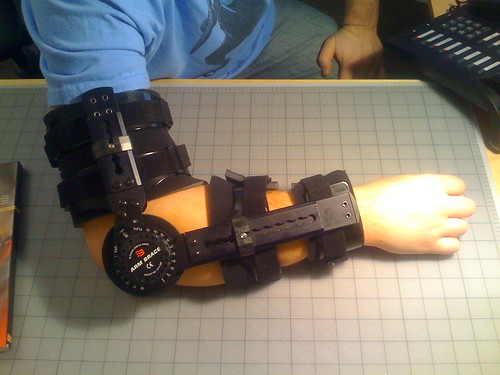 A white person's right arm in a (self-described) terminator-esque arm brace.  It has thick black straps supporting the upper arm, a huge dial on the elbow, and more thick straps on the lower arm