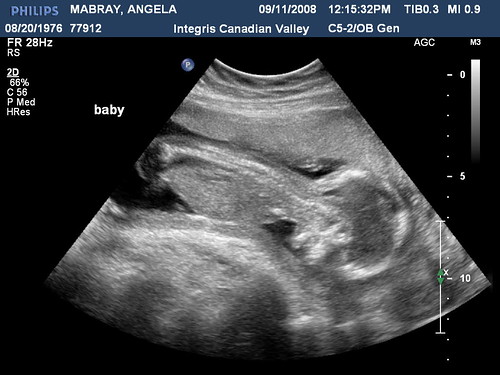 Ultrasound picture of our son