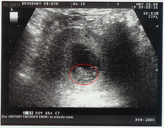 Ultrasound May 28, 2008