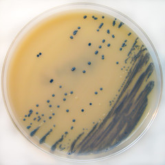 M.R.S.A. Staphylococcus aureus on Brilliance M...
