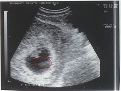 Ultrasound May 13, 2008
