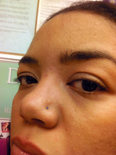 scarring from nose piercing. Nose Piercing by bluedove935
