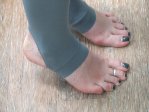 black toes presentation