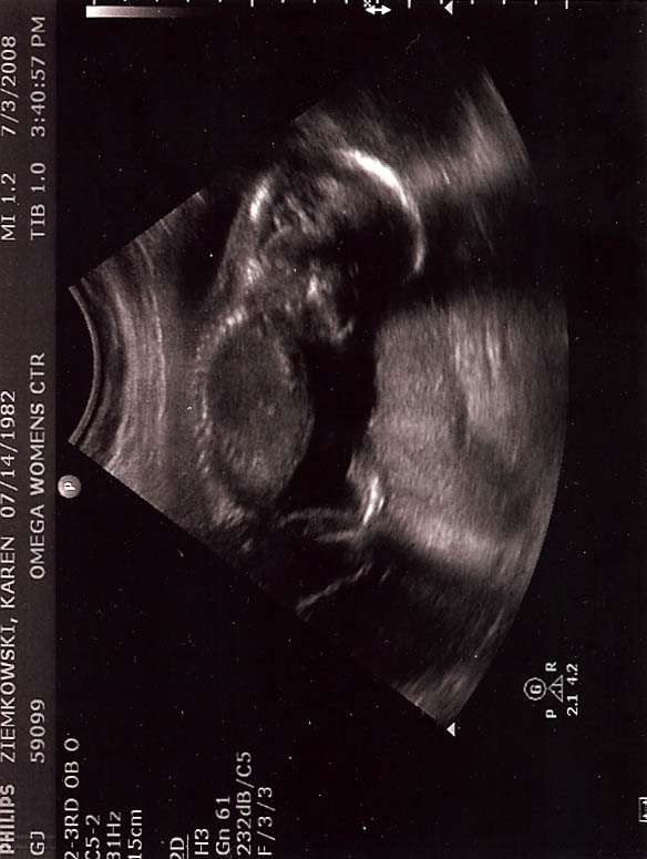Ultrasound - Profile photo