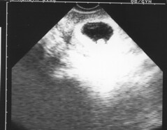 First Ultrasound