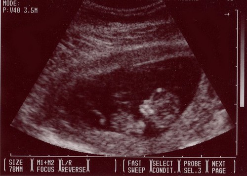 This is my kid: Due June 22, 2009