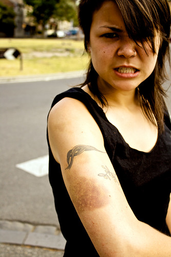 Hana and Her Bruises