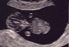 Baby's First Scan