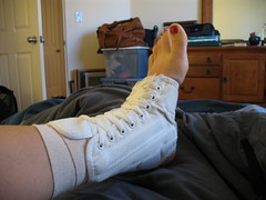 Ann's injured ankle