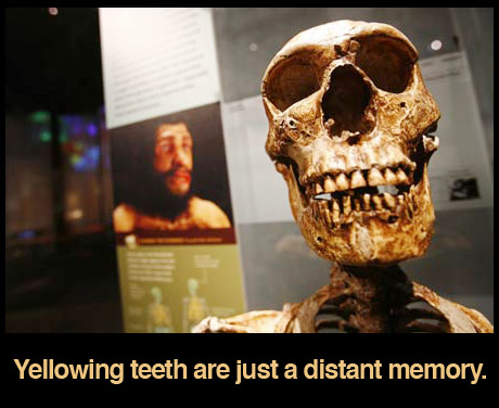 yellowing-teeth