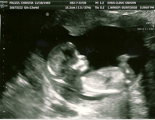 Baby #3 n/t ultrasound