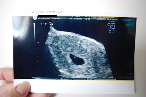 9 weeks pregnant. 9 weeks pregnant. at about 6 weeks pregnant.