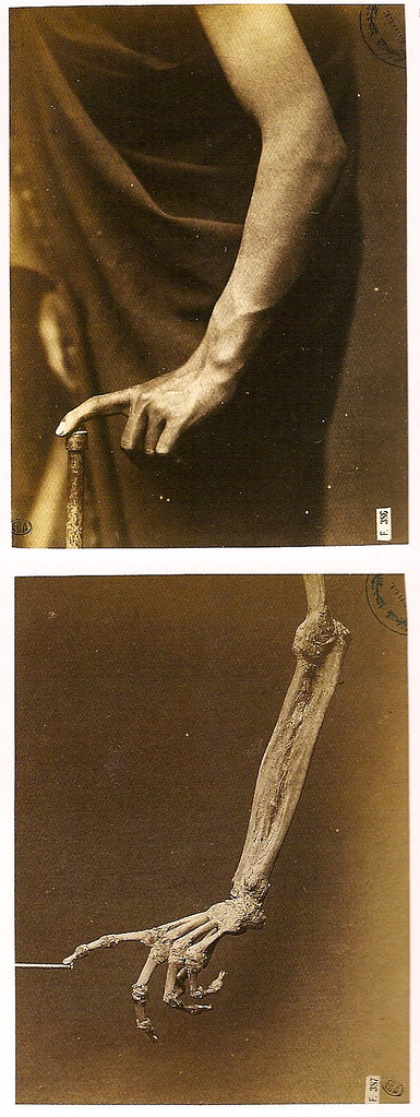 Hermann Heid (Darmstadt, 1834-Vienna, 1891) Étude comparée de la forme dun avant-bras en pronation et de son squelette (1880) 14 by 10.3; 13.8 by 10.3. École des Beaux-Arts, Paris.