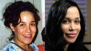 Octomom before-after