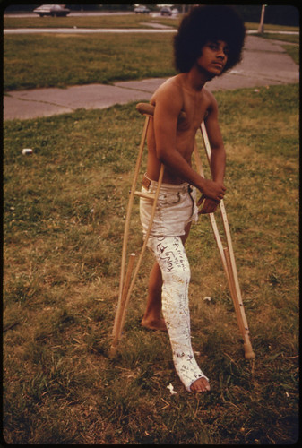 Young Man with His Leg in a Cast in Hiland Park of Brooklyn New York City ... 07/1974