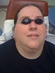 laser hair removal - complete with goggles