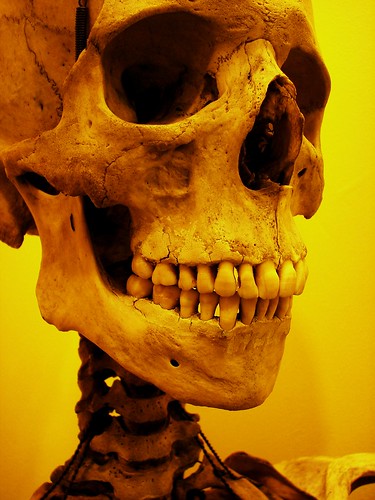 Gorilla skull