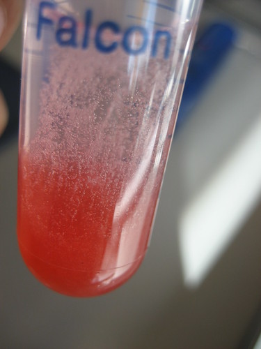 strawberry dna extraction