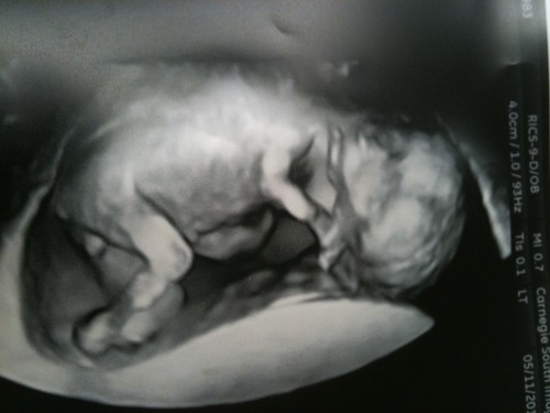 3d ultrasound pictures at 26 weeks. 3d ultrasound 20 weeks boy.
