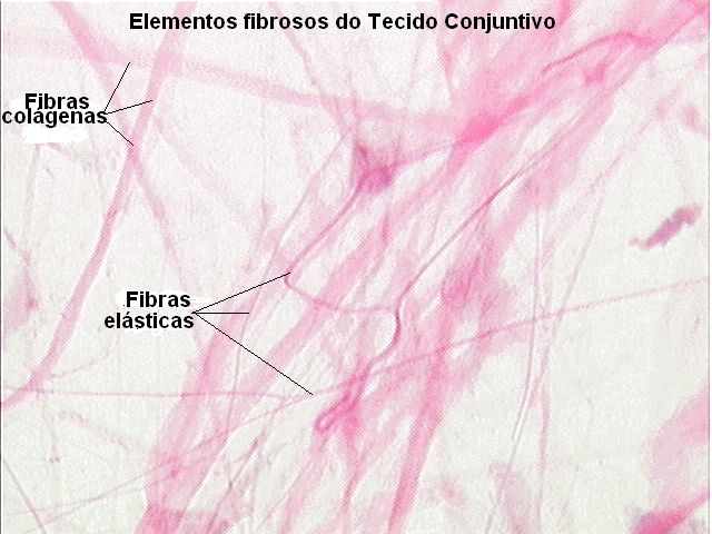 Elementos fibrosos do tecido conjuntivo
