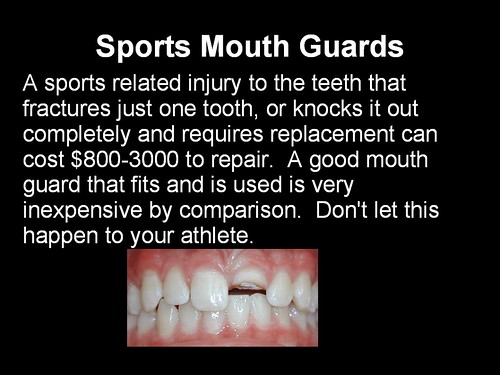 4x Sports Mouth Guards