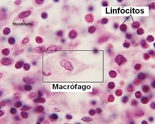 Macrófago e linfocitos