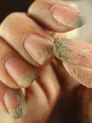 dirty nails