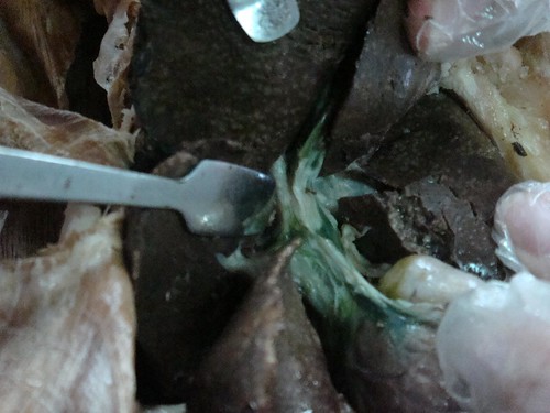 common bile duct cystic duct. 43 cystic duct and common bile