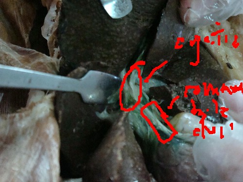 common bile duct cystic duct. 44 cystic duct and common bile duct