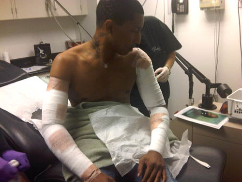 Pharrell feels the burn….of full body tattoo removal