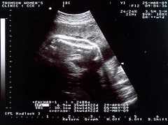 Ultrasound Scan 11.jpg