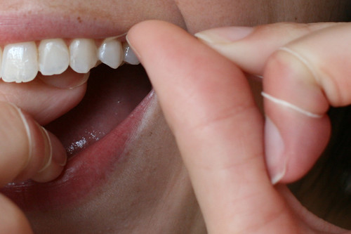 smoking effects on teeth. Effects of smoke-free tobacco
