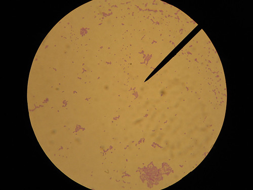 staphylococcus aureus gram stain. S. epidermidis gram stain