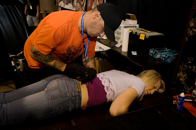 Larry doing micro-dermals on a girl's back dimples.