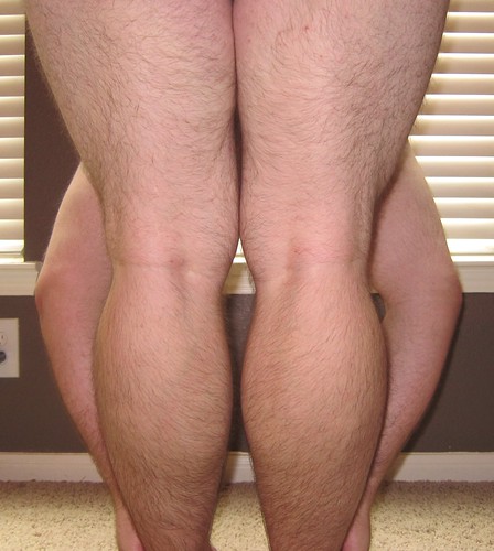 Fat Hairy Legs 74