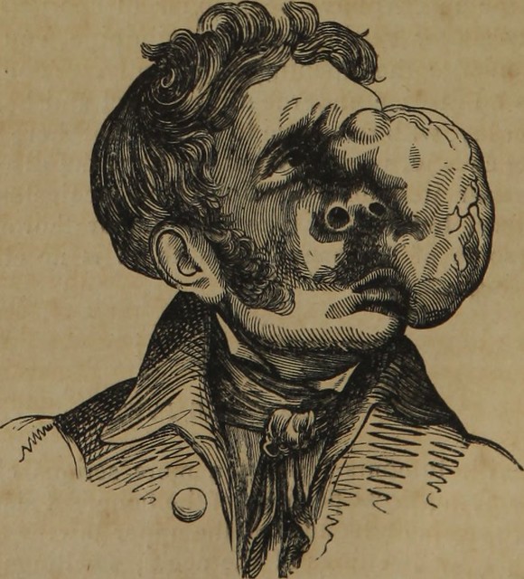 Image from page 295 of Lectures on the operations of surgery : and on diseases and accidents requiring operations (1846)