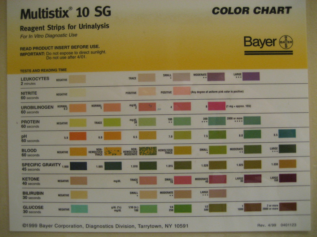 Multistix Urinalysis Chart