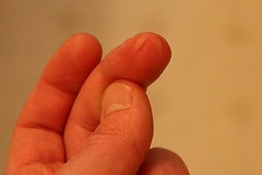 Finger stuck